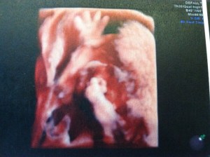 Danger Does the Swim Dance