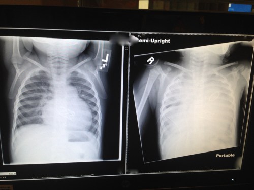 Before and After Crisis